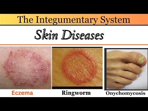 Skin illness photos with names|skin conditions and illness|skin changer|atopic dermatitis ⚡ ⚡